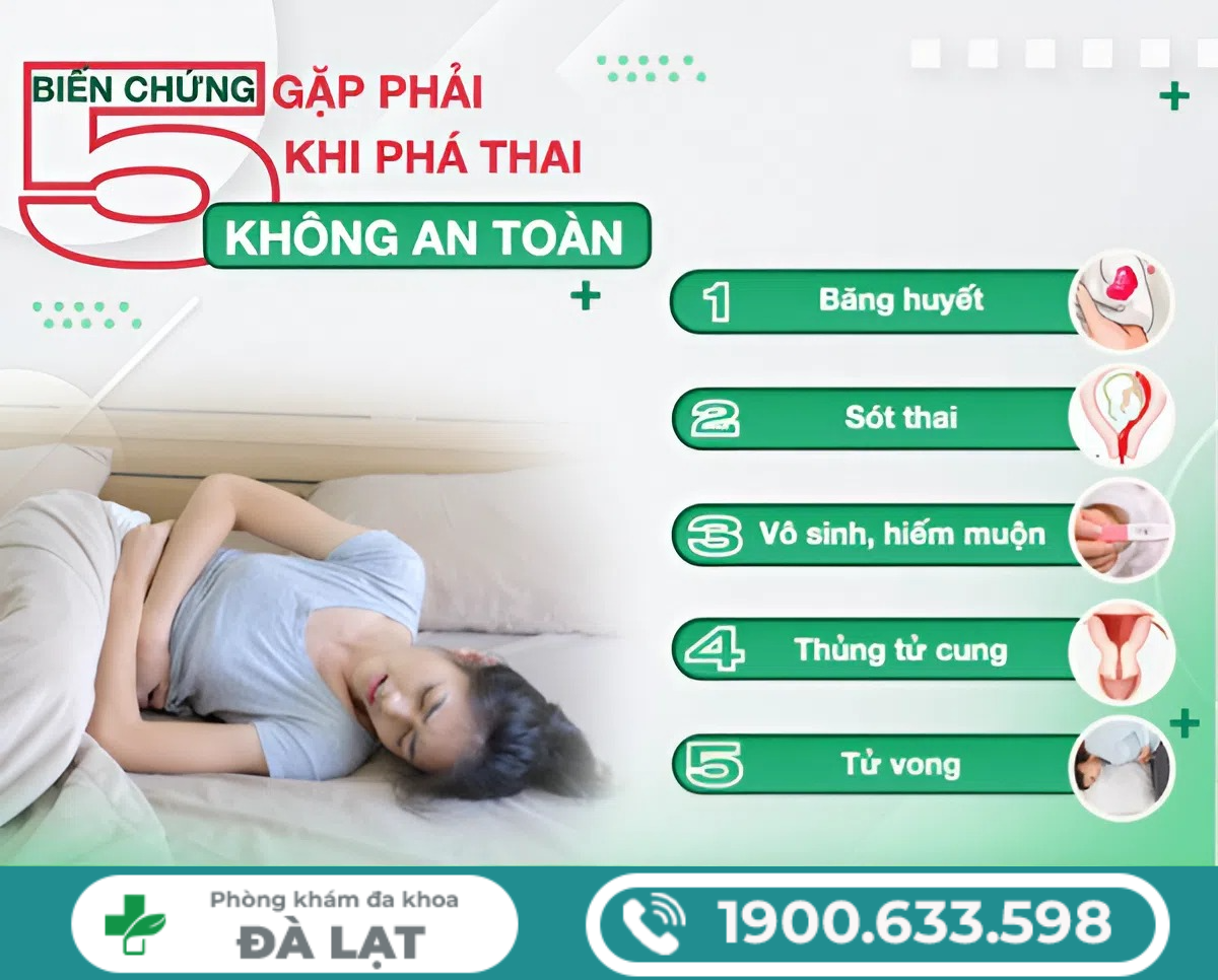 Hình ảnh minh họa